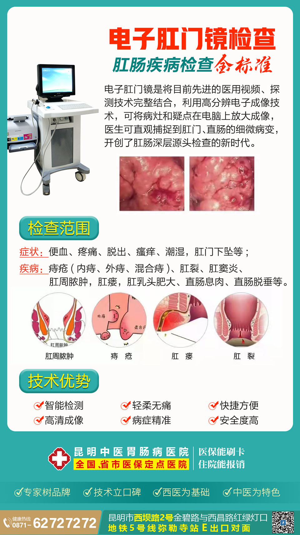 昆明中医胃肠病医院电子肛门镜