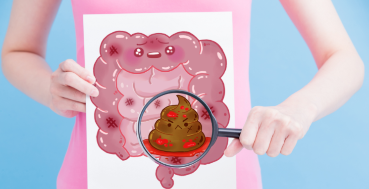 便秘不算“病”吗?七种情况的便秘,可能是肿瘤先兆!